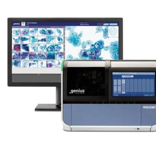 Hologic Genius™ Digital Diagnostics System in white background